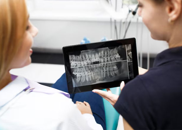 giant smile implante dentista em benfica vidigueira