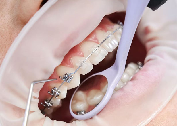 giant smile odontologia 1 dentista em benfica vidigueira
